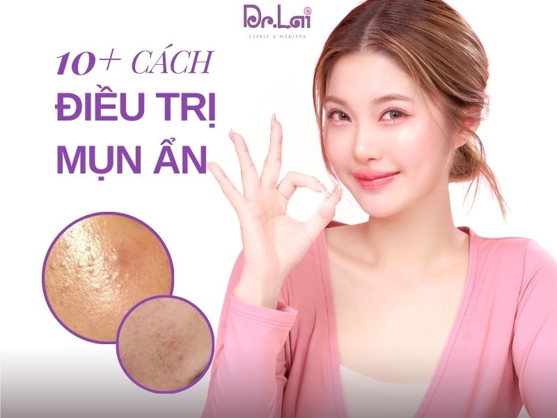 Cách trị mụn trứng cá ở lưng