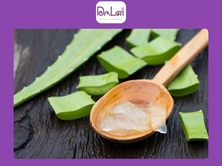 Dùng nha đam hỗ trợ làm dịu mụn viêm