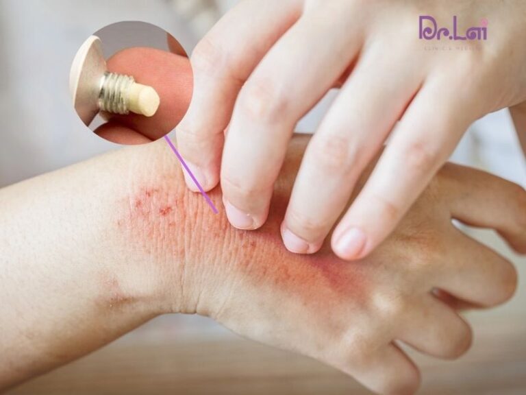 Chăm sóc da trong quá trình điều trị