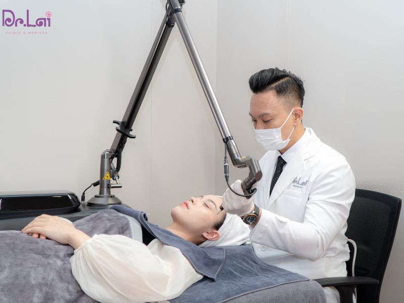 Trị thâm mụn bằng tia laser